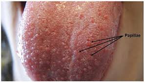 Do You Love The Taste Of Food Find Out If You Are A Supertaster Science Project Health Science Projects Tongue Taste Buds Tasting