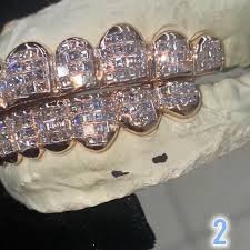 Any style, any mouth, we can create a custom 1 of 1 for your persona 🫣  Swipe & lmk which Flawless Grillz you like best #JohnnyDangWay , 1. King  Invisible Set, 2. King Carré Cut, 3. Honeymoon Set , 4. ...