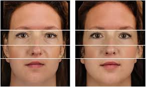 Face value: The effect of facial aesthetic treatment