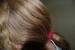 Black Hair Head Lice Infestation