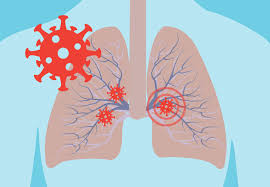Repeat the entire routine three times. Here S The Damage Coronavirus Covid 19 Can Do To Your Lungs Health Essentials From Cleveland Clinic