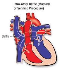 Arteries body diagram main blood. D Transposition Of The Great Arteries American Heart Association