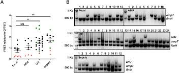 Extra activity for early finishers. Identification And Characterization Of Ompt Like Proteases In Uropathogenic Escherichia Coli Clinical Isolates Biorxiv