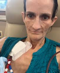 When you REALLY want your patient to increase his protein 😁 Let's do it  together! 💪🏾