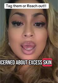 Reshaping Body Whittier Ca