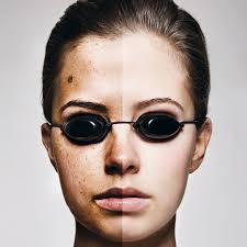 Burn Notice: How the Sun Can Damage Your Health