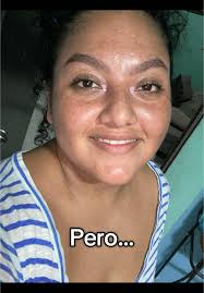 Piel Apiñonada Mujer