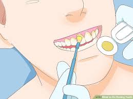 We did not find results for: How To Fix Rotting Teeth Teethwalls