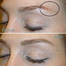 If the tattoo is too saturated, laser is also a good option. Eyebrow Tattoo Correction Juvessentials Is 1 Rated For Cosmetic Tattooing And Correction In The San Francisco Bay Area 490 Post St 647 San Francisco Ca 94102 415 654 5859