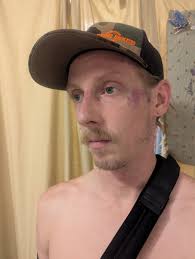 Fundraiser by Kyle Woodworth : Help Kyle Overcome Medical and Housing  Challenges