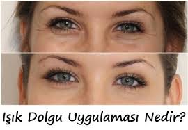 Goz Alti Dolgu Ve Zeltiq Uygulamasi Saglik Haberleri Saglik Yaslanma Gozler