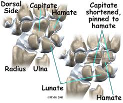Image result for Capitate Bone