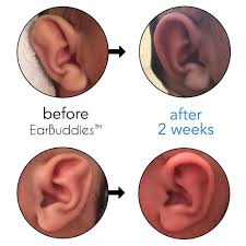 If your ears sticking out is one of those things, there are a few tricks to making them less noticeable. Newborn Babies Ears Ears That Stick Out Baby Earing Stick It Out