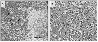 Ptr record is set to 185.63.253.200. Frontiers Pelleted Bone Marrow Derived Mesenchymal Stem Cells Are Better Protected From The Deleterious Effects Of Arthroscopic Heat Shock Physiology