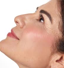 COLORETE EN BÁLSAMO