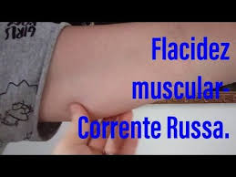 A corrente russa é um procedimento estético que atua através de estímulos elétricos, por meio de a corrente russa surgiu nos anos 80 e até hoje apresenta bons resultados. Flacidez Muscular Corrente Russa No Tratamento Youtube Muscular Tratamento Flacidez Da Pele