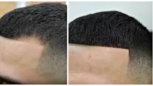 How To Apply Hair Fiber Toppik By Will Perez Youtube