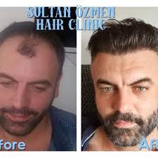 Sultan Özmen Hair Clinic in Bagcilar, Istanbul • Read 14 Reviews