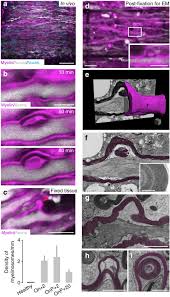 Myelinosome formation represents an early stage of oligodendrocyte damage  in multiple sclerosis and its animal model
