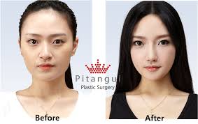 And doesnt looks like jessica at all. Dj Leng Yein Before Plastic Surgery Leng Yein Lady Leng Yein Women Tops Camisole Top Pump Up The Volume Leng Yein Spencer Tarring Full Version Wadyono Uni
