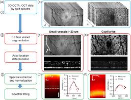 Jun 20, 2021 · according to octa research, davao city recorded an average of 252 new cases per day — higher than the previous week's recorded average of 177. Visible Light Optical Coherence Tomography Angiography Vis Octa And Local Microvascular Retinal Oximetry In Human Retina Biorxiv