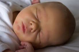 Check spelling or type a new query. Newborn Jaundice Nhs