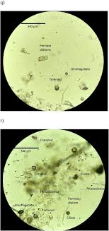 Intense storms affect sinking particle fluxes after the North Atlantic  diatom spring bloom