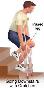 Crutches Downstairs Broken Ankle Recovery Nursing Tips Nursing School Studying