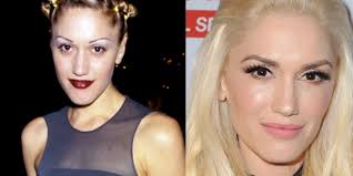 Today's cosmetic surgery is so advanced that it is hard to imagine any celebrity not being influenced by the miracles that surgery can bring. Gwen Stefani Plastic Surgery Lip Augmentation And More Celebrity Plastic Surgery Transformation By Anna Maria Medium