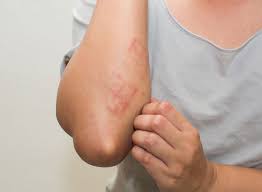 9 Gluten Intolerance Symptoms To Never Ignore Eat This Not That