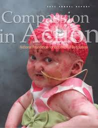 NFED Ectodermal Dysplasias 2012 Annual Report