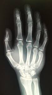 Necromancy Magic Dungeoncrawling Necromancy Spell Magic Dnd Inspiration Fantasy Jrusso In 2020 Xray Art Hand Anatomy Anatomy