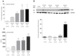 4 more scenarios for peter gates brainstem rule of 4. Ijms Free Full Text Hypoxia Induces Astrocyte Derived Lipocalin 2 In Ischemic Stroke Html