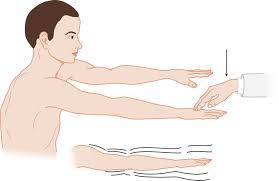 Image result for Cerebellar Function Test