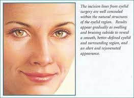 Eyelid Surgery Beverly Hills