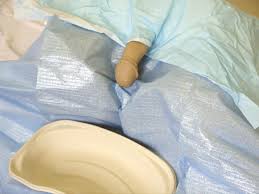 Image result for Urethral Catheterization