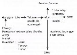Otitis media supuratif kronik adalah jenis otitis media kronik dengan manifestasi klinis adanya perforasi gendang telinga dan otore yang menetap atau berulang sebagai kelanjutan dari otitis media akut. Otitis Media Akut