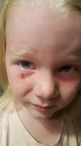 Is the Rhode Island Red hen protecting the other hens when they lay eggs?