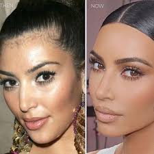 Plastic Surgeon Dr Kassir Drkassir Instagram Photos And Videos Celebrity Hair Stylist Celebrity Makeup Artist Celebrity Hairstyles