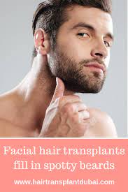 Pin On Beard Hair Transplant