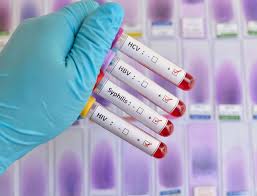 Do you think you have been exposed to hiv virus and do not know what to do next? Std Screening And Treatment Chye Family Medicine Specialist Clinic