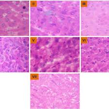 Draw the outline of a few starch grains as seen under hp (at least 5cm in diameter). Histopathology Of Liver Tissues Under 40x Microscope I Normal Download Scientific Diagram