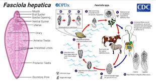Clonorchiasis, or chinese liver fluke disease, is caused by infection with clonorchis sinensis.adult c. Fasciola Hepatica Common Liver Fluke Or Sheep Liver Fluke