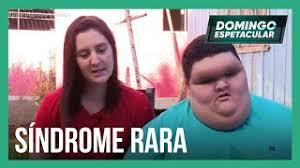 A emissora de tv aberta rede record, que possui sede em são paulo, foi o programa domingo espetacular é exibido desde abril de 2004 e possui um formato bastante. Menino De 10 Anos Chega Aos 200 Kg Mas Medicos Nao Conseguem Diagnosticar Doenca Youtube