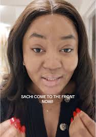 Hyperpigmentation Girl Front View