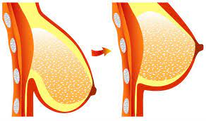 Il en existe une multitude d'autres. Voici Comment Raffermir Ses Seins En Deux Etapes