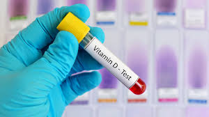 Feb 17, 2021 · vitamin d acts on our bones, intestines, kidneys and parathyroid glands to keep calcium in balance throughout our body. Vitamin D Mangel Richtig Erkennen Und Erfolgreich Beheben Ndr De Ratgeber Gesundheit