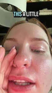 PSA 🗣️🗣️🗣️ DON'T PICK AT UR FACE !!!! #nurse #nursesoftiktok #cellu...