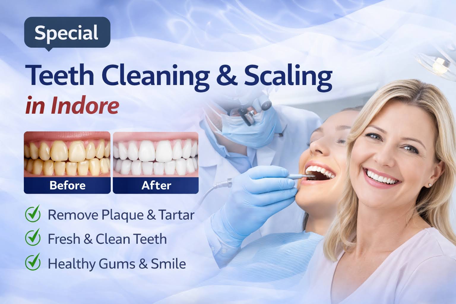 Teeth Cleaning & Scaling in Indore product image