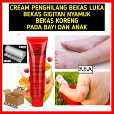 Tidak hanya itu saja, dalam lemon juga terkandung asam alpha hidroksi yang dapat menangkal radikal bebas yang ada dalam kulit sehingga bekas luka pada kaki akan memudar seiring berjalannya waktu. Cream Penghilang Bekas Luka Bekas Gigitan Nyamuk Pada Bayi Dan Anak Shopee Indonesia